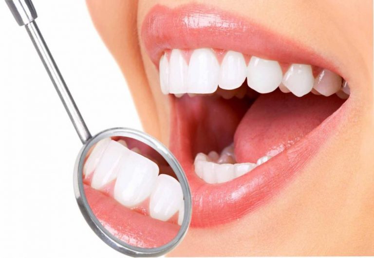 Solusi Perawatan Gigi Di Niti Dentist Cempaka Putih